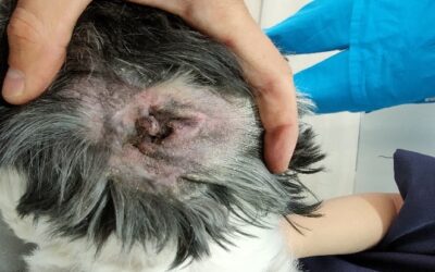 Otitis por Pseudomonas Aeruginosa